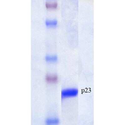 SDS-PAGE: Recombinant Human p23/PTGES3 Protein [NBP3-18323]